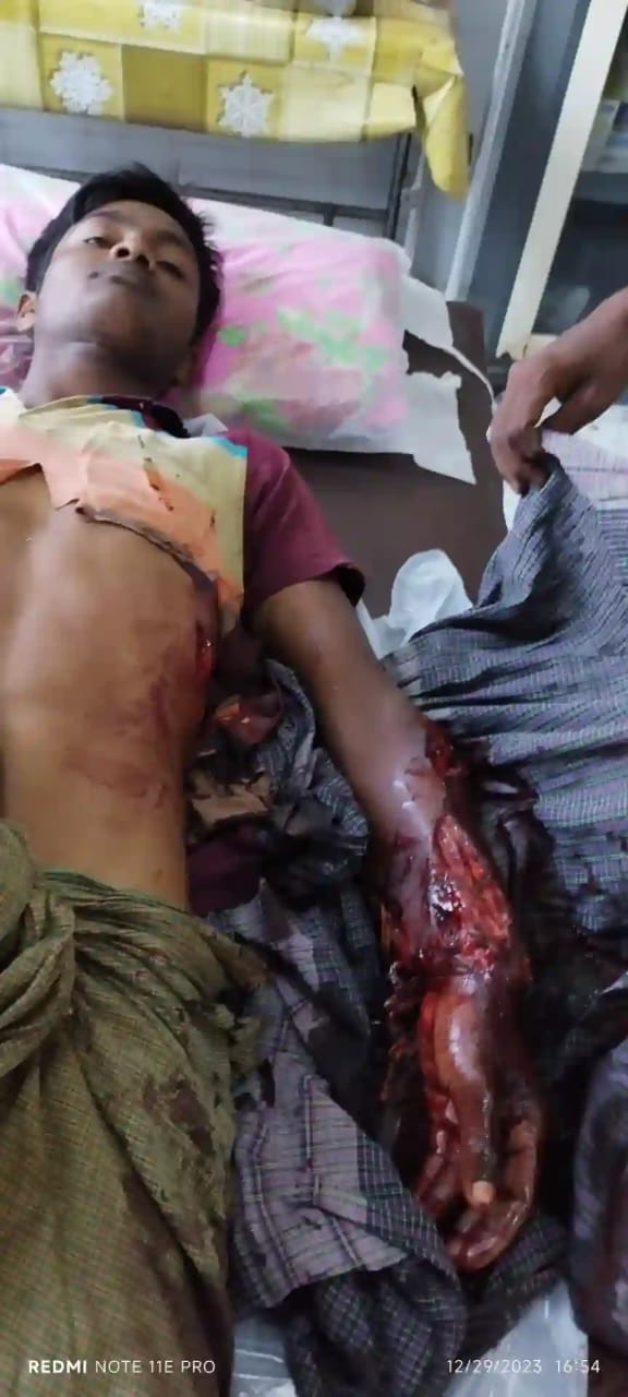 MILITARY BOMBARDMENT KILLED AT LEAST 12 AND INJURED OVER 100 ROHINGYA IN BUTHIDAUNG
